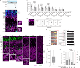 Confined migration induces non-lethal DNA damage in developing neurons
