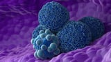 A Game-Changing Drug for Pancreatic Cancer Just Got FDA Approval
