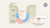 A high-fat, low-carbohydrate diet can feed intestinal tumours