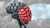 Scientists reverse Parkinson’s symptoms in mice — Could humans be next?