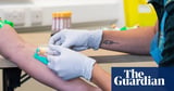 Ovarian cancer blood test can detect disease early, study suggests