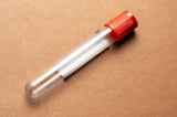 Simple blood test could accurately detect ovarian cancer in its early stages